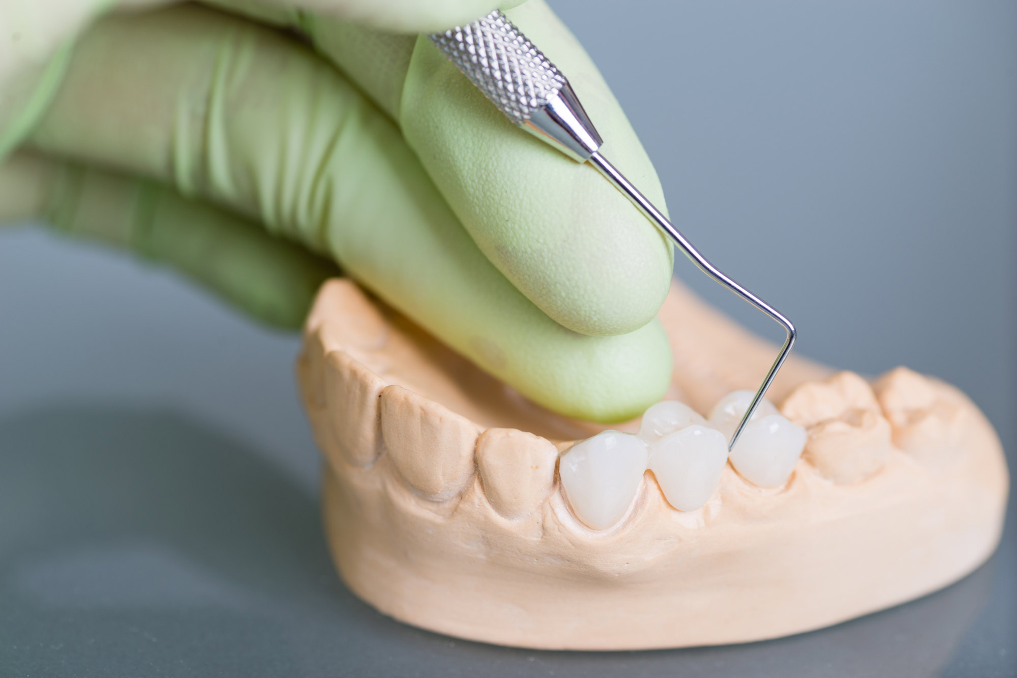  Oralchirurgie_Bunse_Zahnheilkunde-Zahnersatz_Fotolia_77967480_L.jpg